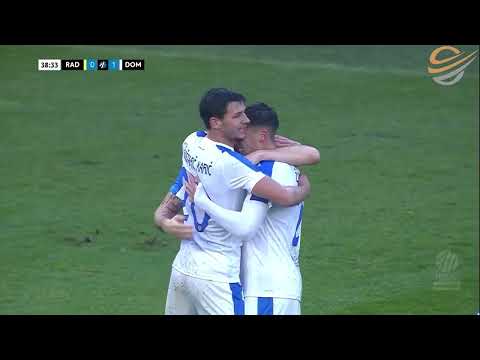 Iskustvo pacijenta: konsultacija i proces transplantacije kose